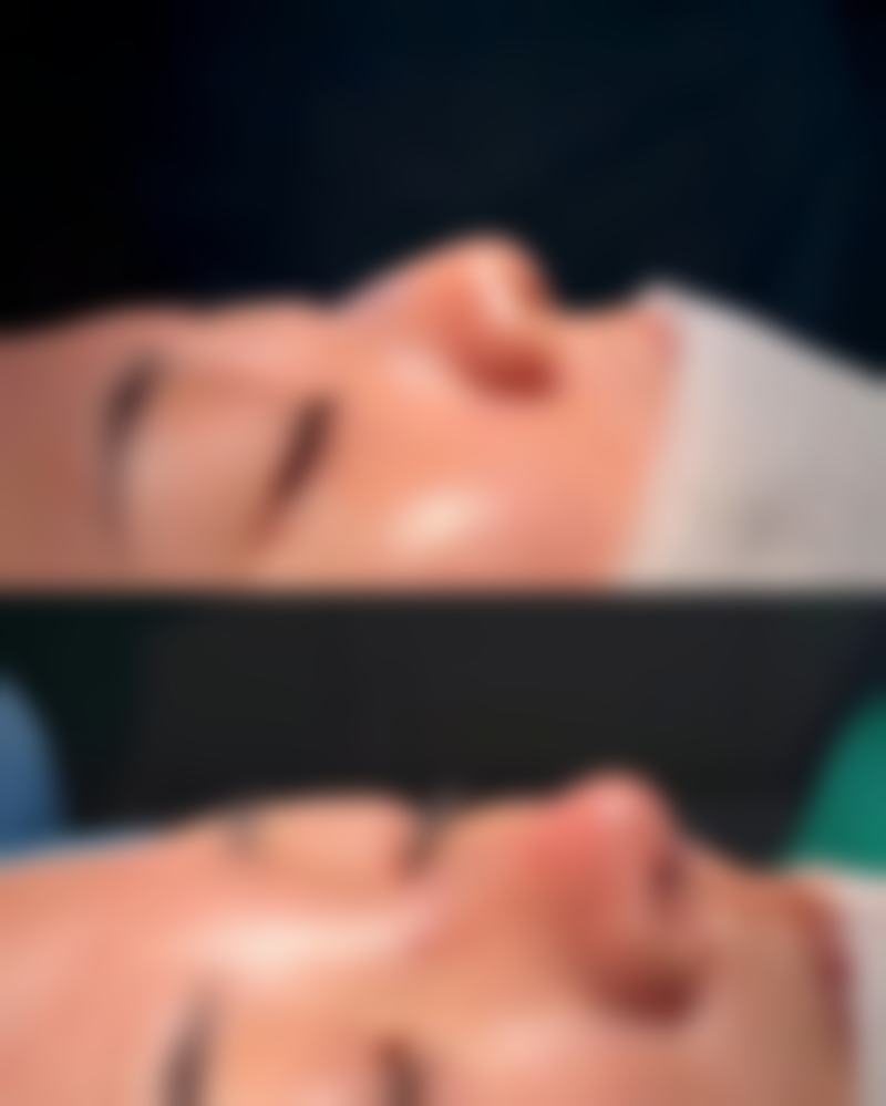做了双眼皮多久可以化妆?埋线与全切恢复时间不同，看完你就有数啦