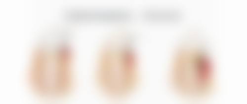 二、开扇双眼皮和平扇双眼皮的适用人群