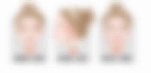 二、判断疤痕突出的类型