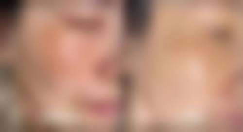 八、深圳素美医疗美容诊所真实的患者评价