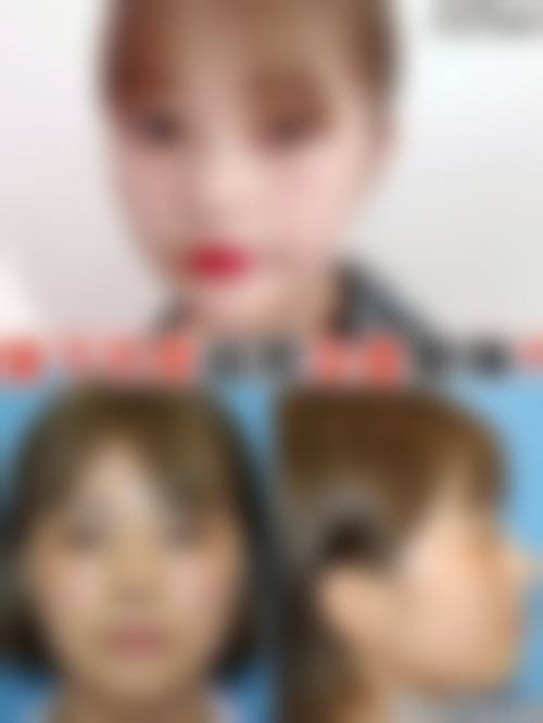 二、深圳素美医疗美容诊所怎么样?