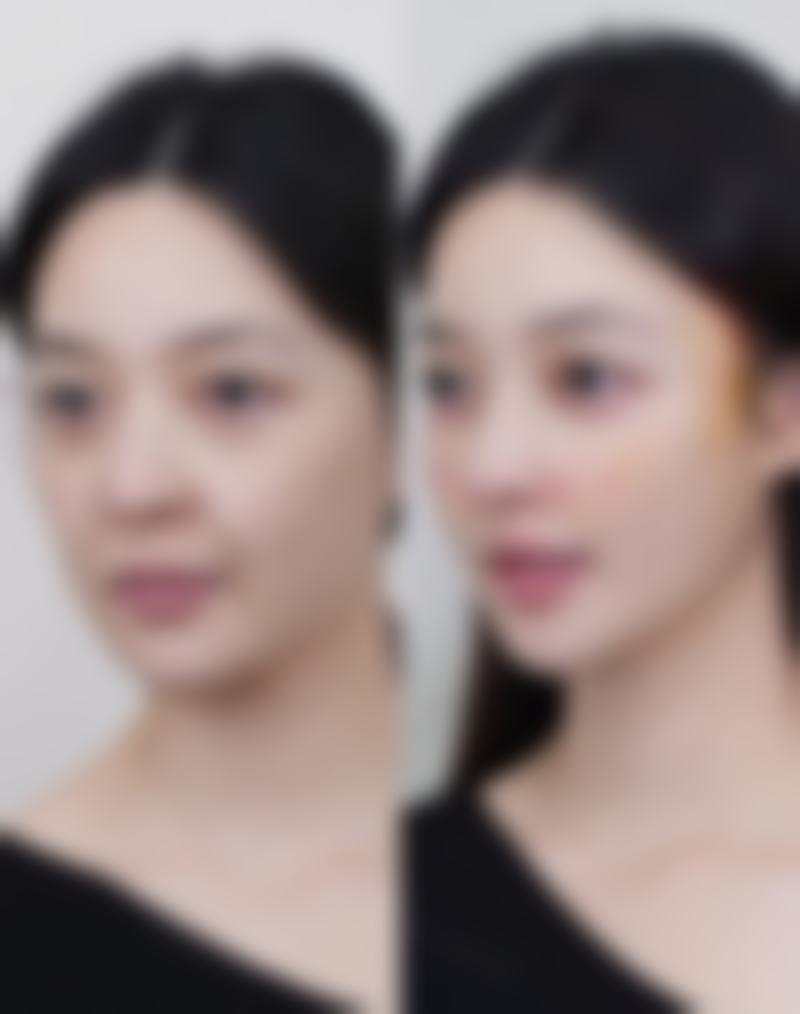 四、深圳素美医疗美容诊所特色项目
