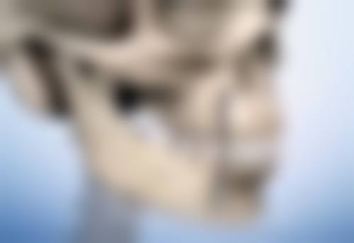 五、手术治疗消除眼袋纹