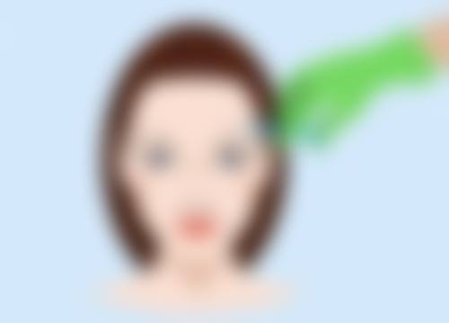 二、打了除皱针脸下垂的修复方法