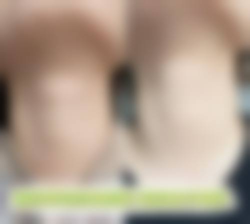 四、南通柒颜整形医院特色项目