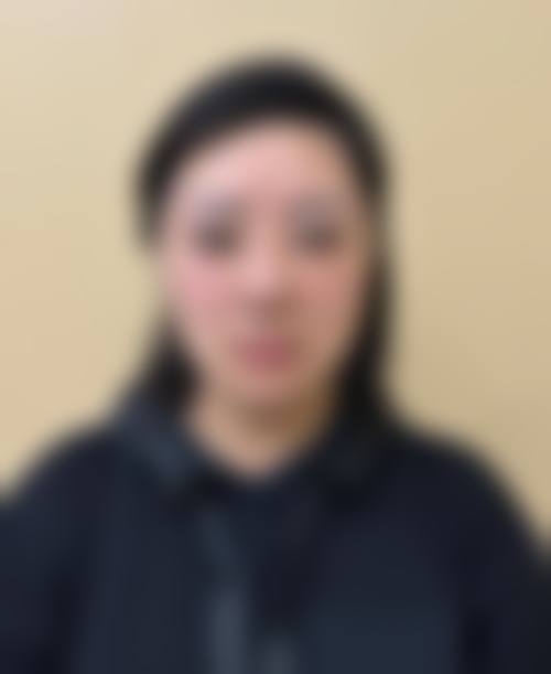 八、延安贝芙丽医疗美容门诊部真实的患者评价