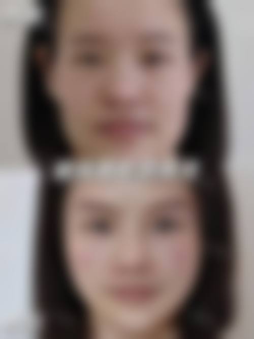 二、北京颜悦医疗美容诊所怎么样?
