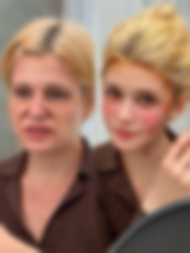 三、打了除皱针脸下垂修复的注意事项