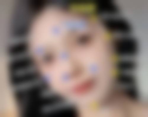 一、打瘦脸针后运动的总体原则