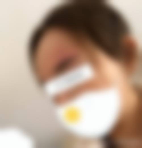 八、连云港美缔整形医院预约方式