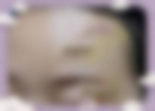四、鸡西宏敏整形外科诊所特色项目