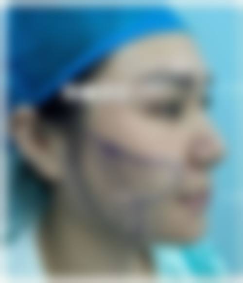 八、鸡西宏敏整形外科诊所真实的患者评价