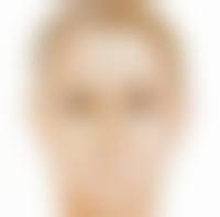 一、哪做双眼皮的手术好之沈阳北方整形医院