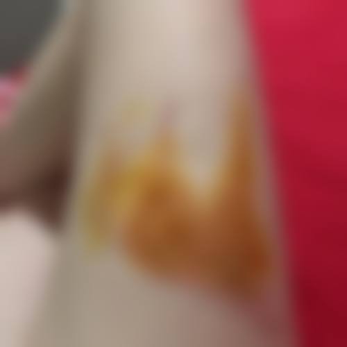 六、郭红磊真实的患者评价