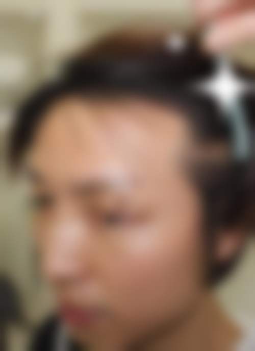 三、郑州肤康植发科诊疗项目有哪些?