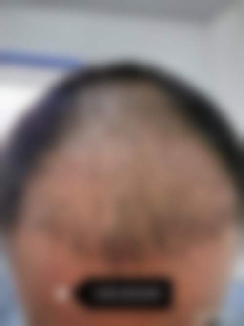 七、郑州肤康植发科地址及交通