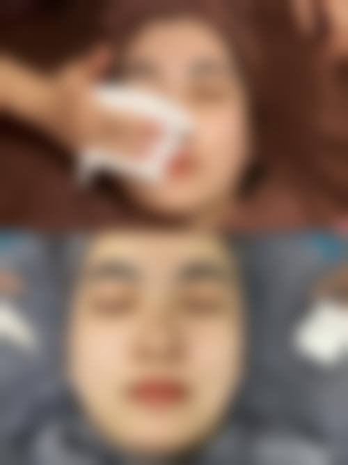 九、江苏昆山铂特丽医疗美容真实的患者评价
