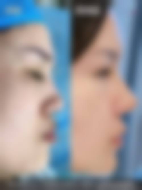 三、郴州市第一人民医院(烧伤整形外科)诊疗项目有哪些?
