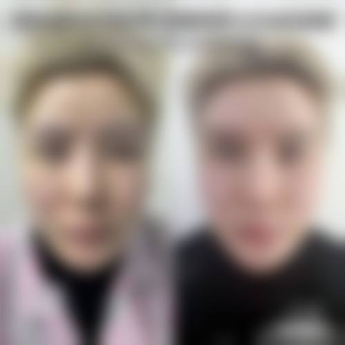 八、郴州市第一人民医院(烧伤整形外科)预约方式