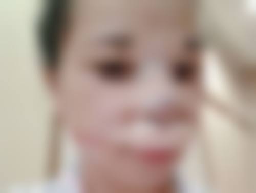 五、双眼皮手术后的日常护理要点