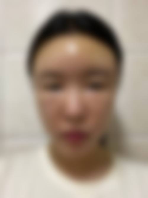 四、郴州玖悦整形医院特色项目