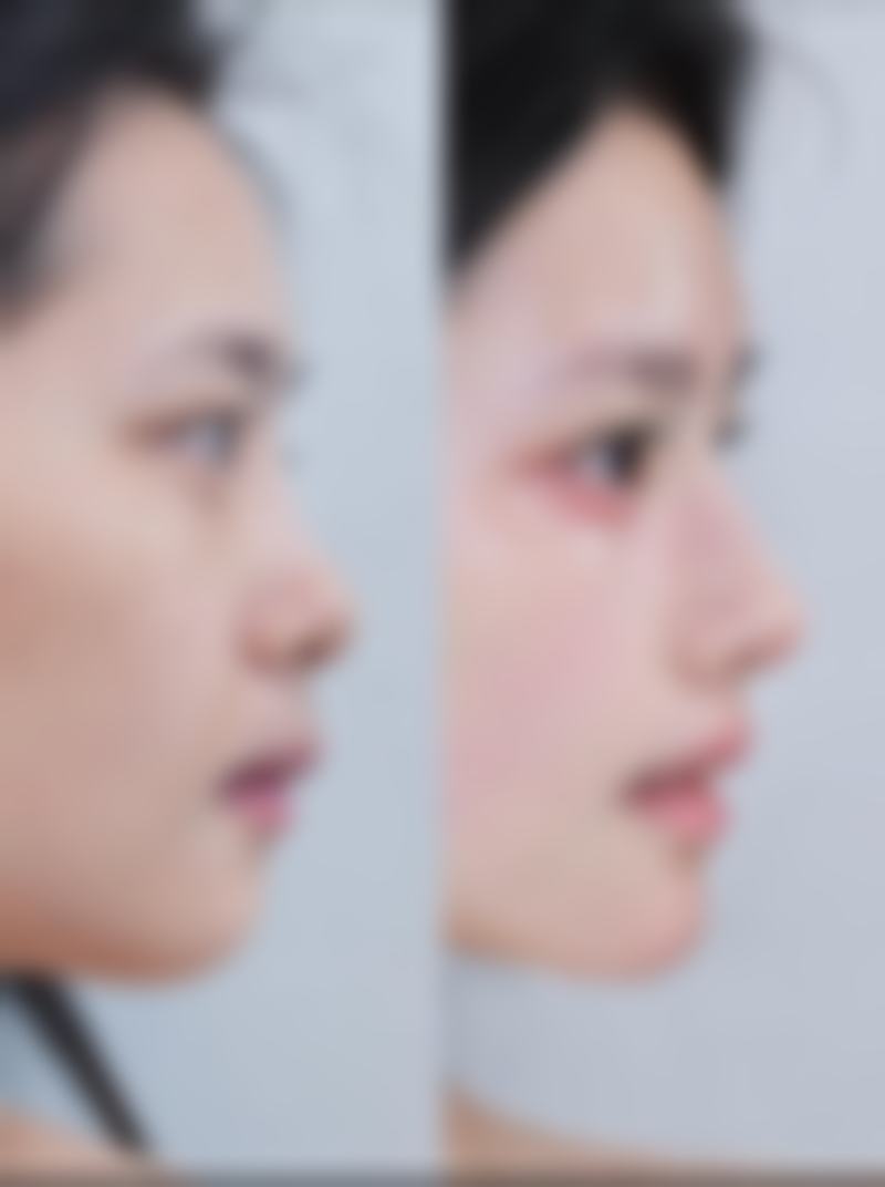 四、常德万禧华美整形医院特色项目