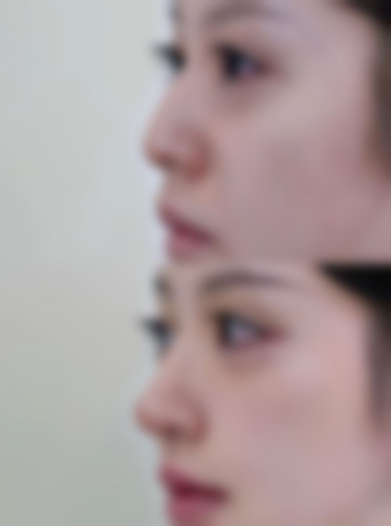 五、常德万禧华美整形医院价格表