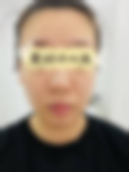 四、船桥中央皮肤科特色项目