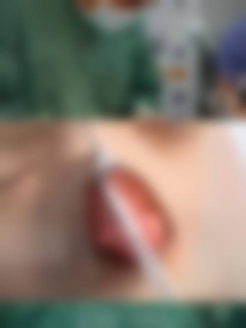 三、船桥中央皮肤科诊疗项目有哪些？