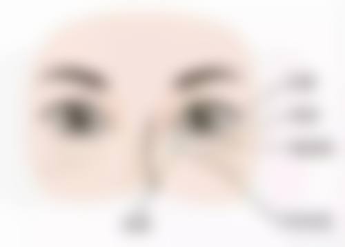 六、手术刀口疤痕修复异常的处理