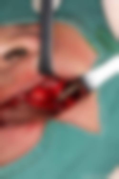 四、杭州禾本整形医院特色项目