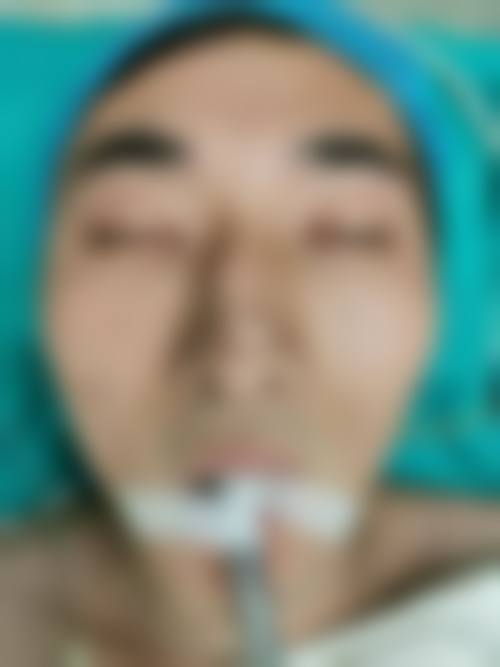 三、肇庆市艾美医疗美容门诊诊疗项目有哪些?