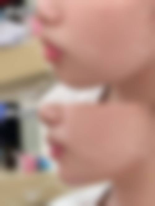 八、重庆德艺阿蓝医疗美容门诊部真实的患者评价