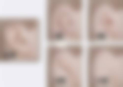 二、割完双眼皮的海鲜发物忌口