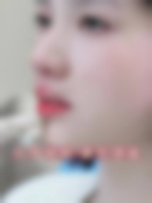 二、广州美丽医然医疗美容门诊部怎么样?