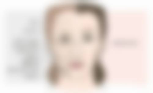 四、去眼袋手术后的注意事项