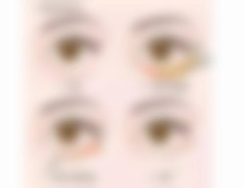 四、使用眼膜贴的注意事项