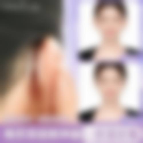 八、无锡百年医疗美容门诊有限公司预约方式