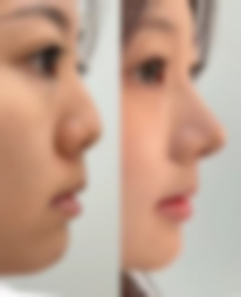 四、重庆丽瑾亚美整形医院特色项目