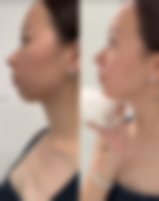 七、重庆丽瑾亚美整形医院预约方式