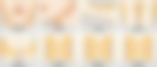五、如何延长双眼皮埋线的维持时间