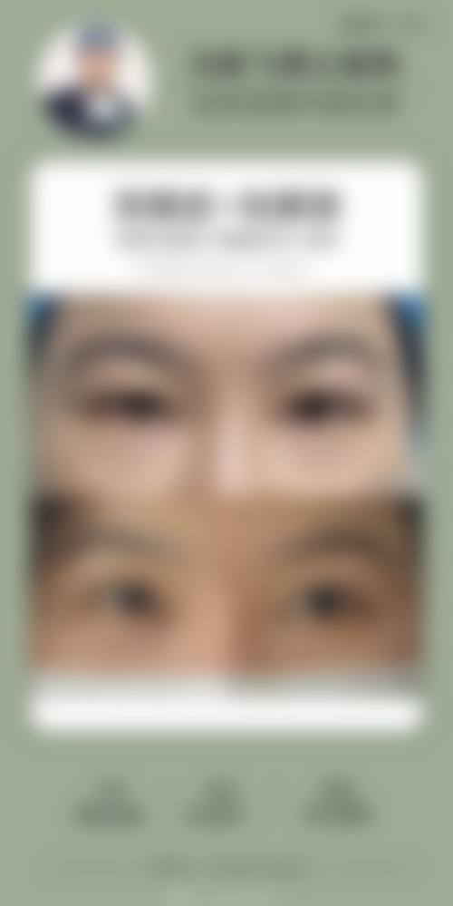 九、凯伦秀整形外科真实的患者评价