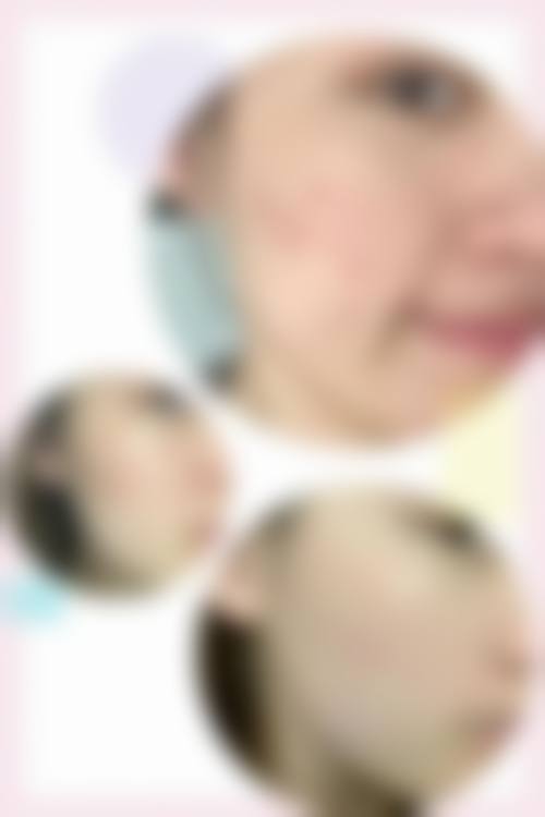 二、无锡美呈医疗美容门诊部怎么样？