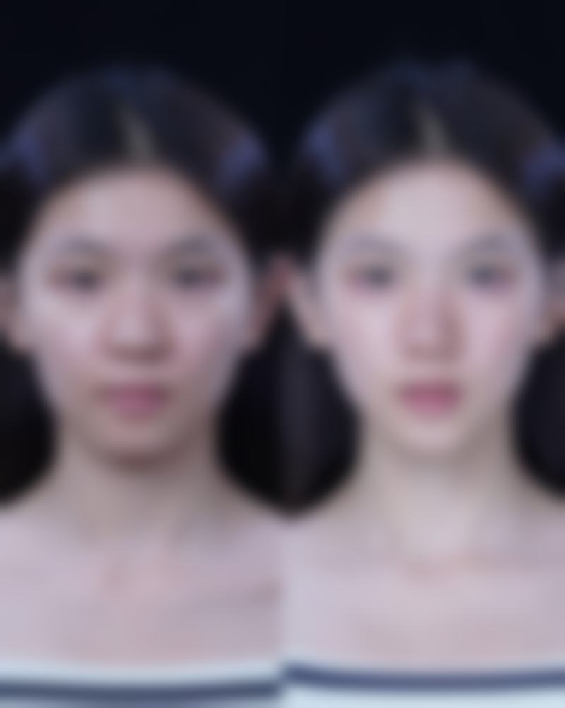 男生消除眼袋黑眼圈简单方法大揭秘，附改善前后对比图片参考！ 