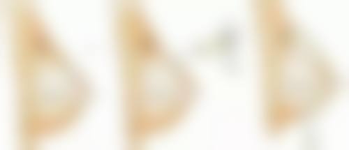 一、割完双眼皮一直流眼泪正常吗?常见正常原因分析