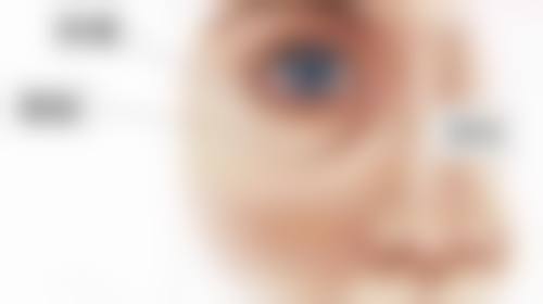 二、割完双眼皮一直流眼泪正常吗?异常情况需警惕