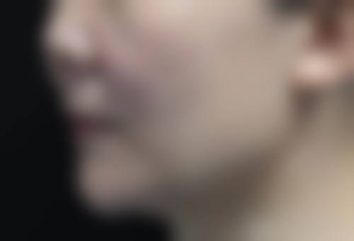 八、南昌漾歌医疗美容门诊部真实的患者评价