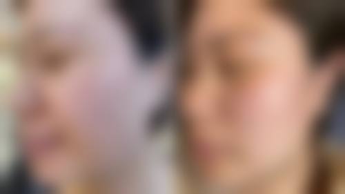 二、大连美天整形医院怎么样?