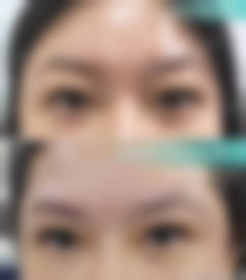 四、衢州柯城馨丽莱整形医院特色项目