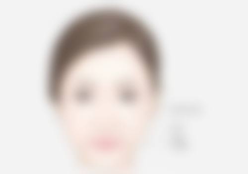 假体隆胸手术后有后遗症吗？了解常见风险及图片示例，助你安全变美 